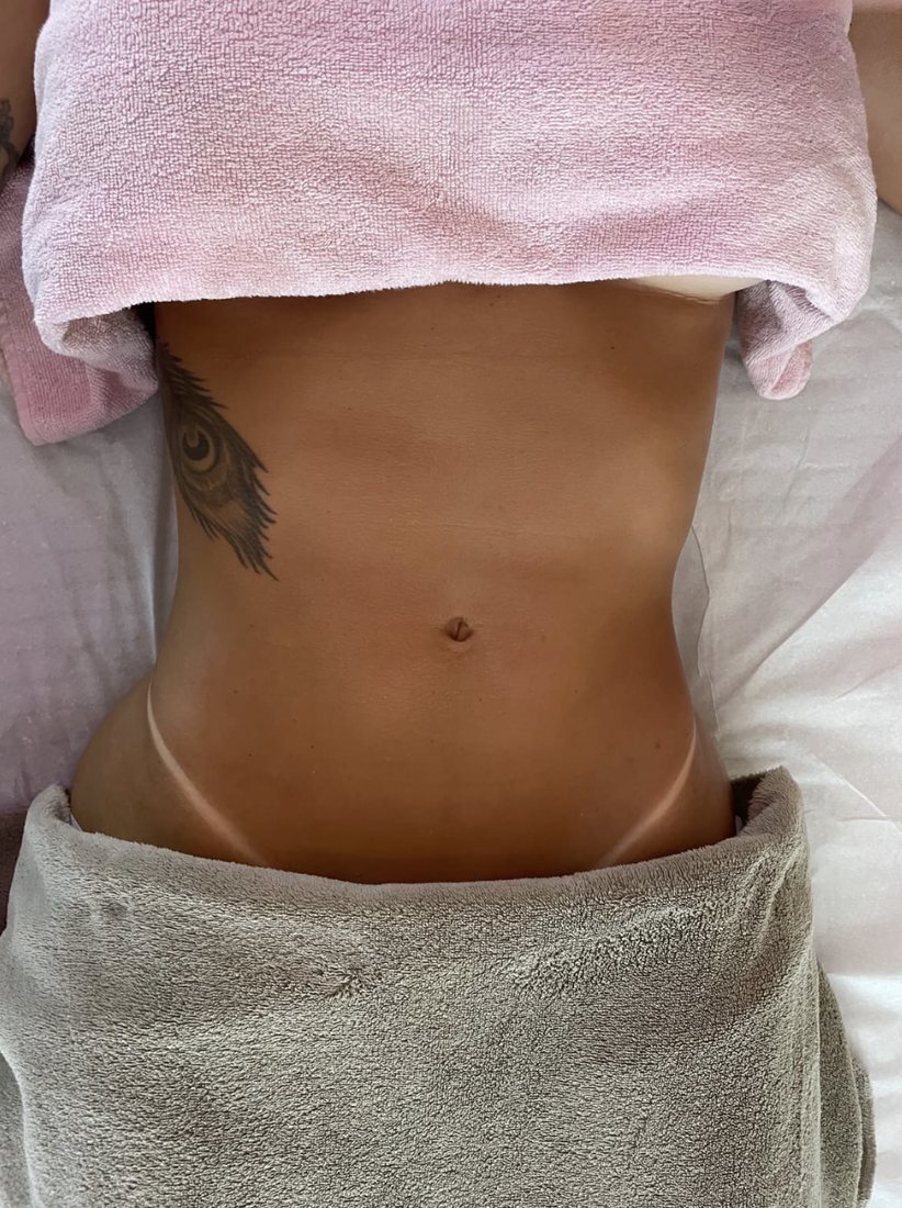 Antes da sessão de massagem modeladora, vista frontal do abdômen