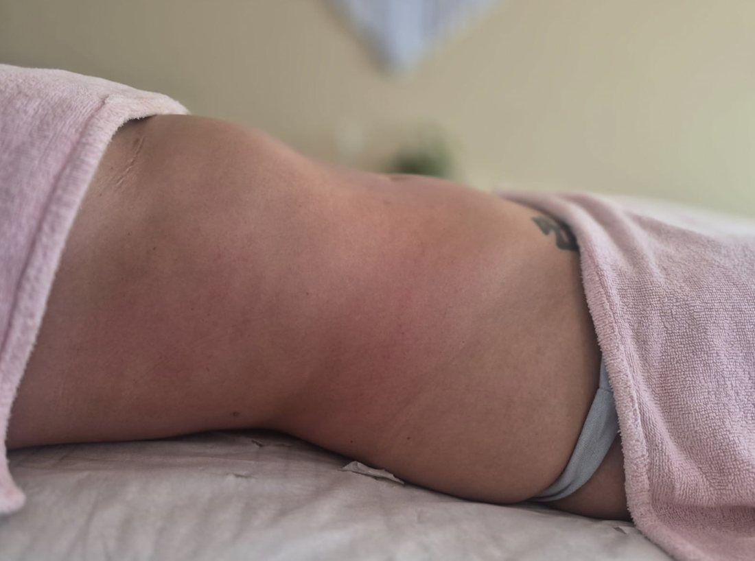 Depois da sessão de massagem modeladora nos flancos