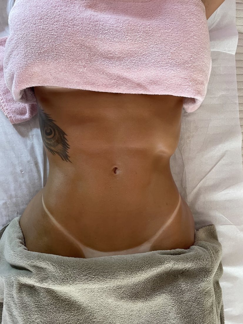 Depois da sessão de massagem modeladora, vista frontal do abdômen