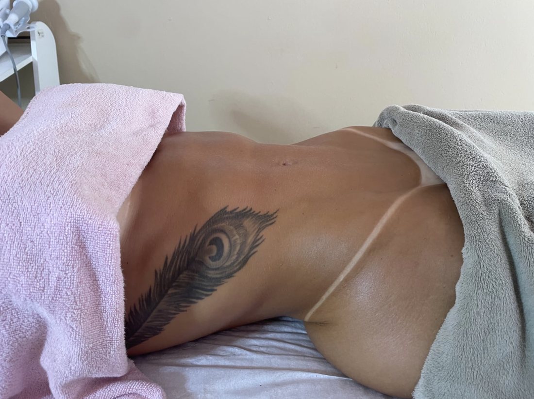 Depois da sessão de massagem modeladora, vista lateral